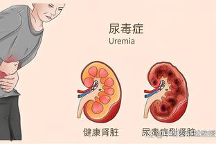 拜仁公布与勒沃库森榜首战海报：萨内、凯恩、穆西亚拉出镜